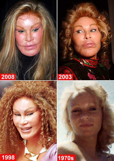 Jocelyn Wildenstein 