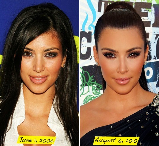 kim kardashian plastic surgery before and after photosphoto