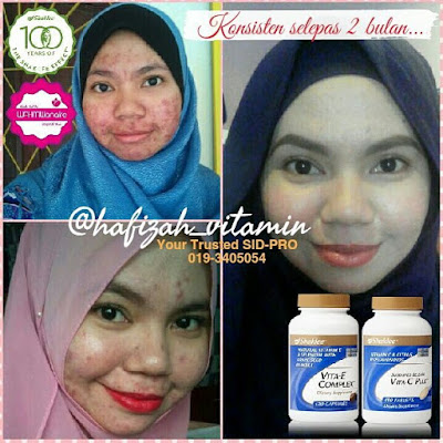 kelebihan vitamin C Shaklee