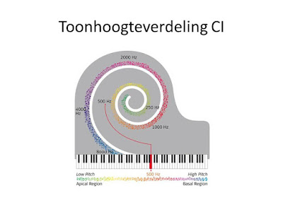 Toonhoogteverdeling CI