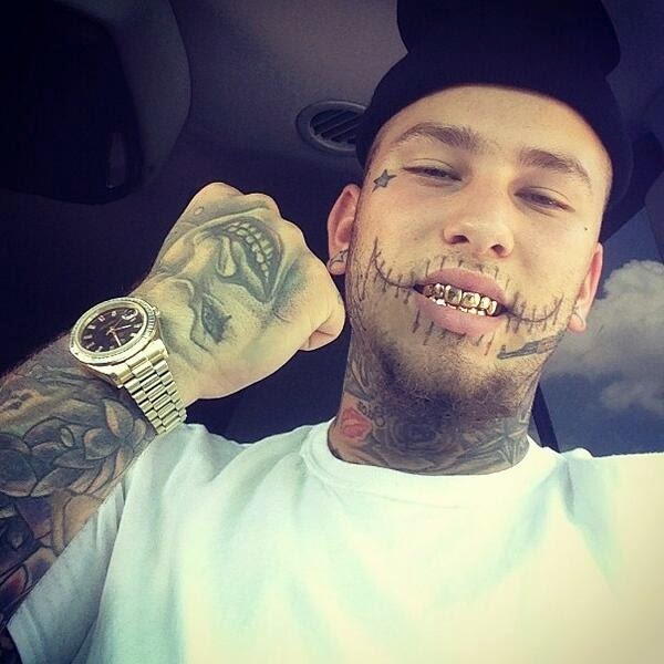 Stitches - una estrella en ascenso de blanco rap