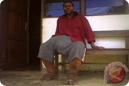 Hermanus Tata, Guru Honorer di Sarmi yang Menderita Filariasis dan Hernia