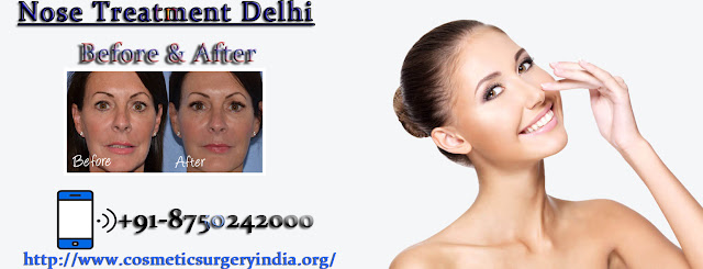 Nose Surgery in Delhi