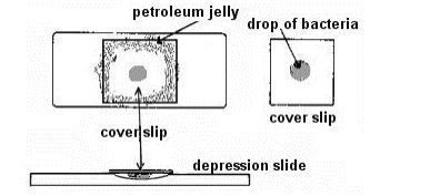 Pemeriksaan Tetes Gantung Bakteri