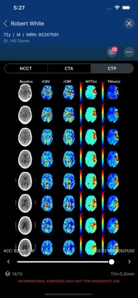 Viz.ai-AI-driven Synchronized Stroke Care Platform