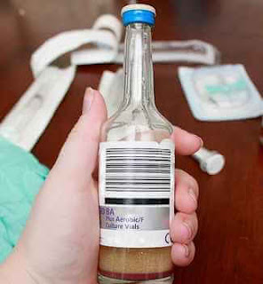 kan kültür şişesi