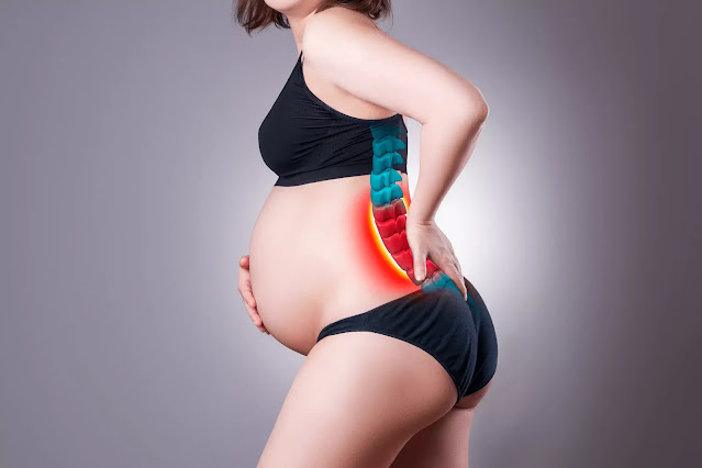 Sciatica-in-Pregnancy.webp