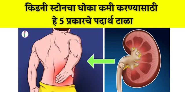 kidney stone avoid food list in marathi