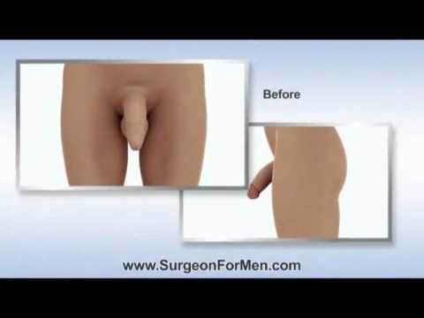 Male Enhancement Works Yahoo Answers : Breast Massage And Natural Breast Enlargement