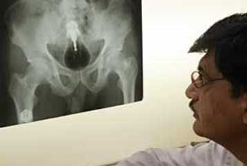 Top 10 Strange and Weird x-ray images Seen On www.coolpicturegallery.net