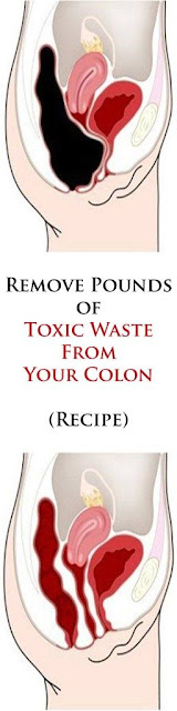 Remove Pounds of Toxic Waste From Your Colon – Recipe