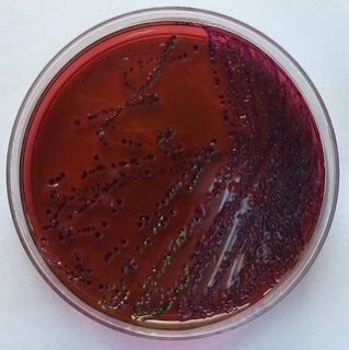 gaita kültürü emb besiyerinde üreyen bakteriler