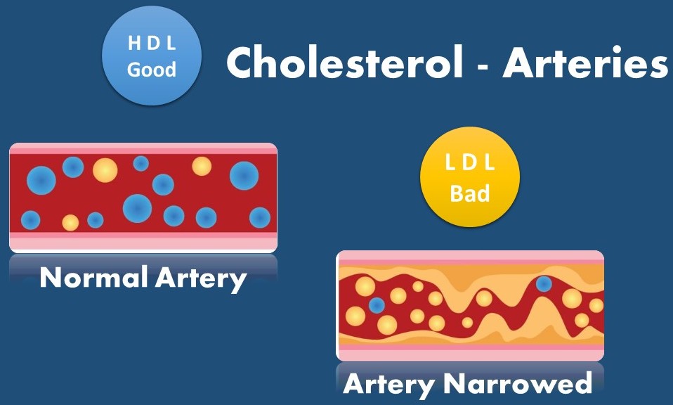 Cholesterol