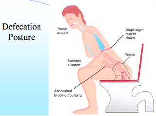 Le Perinee Et La Constipation