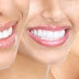 Bạn biết gì về phương pháp tẩy trắng răng?