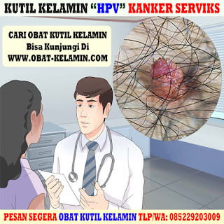 Obat Kutil Kelamin