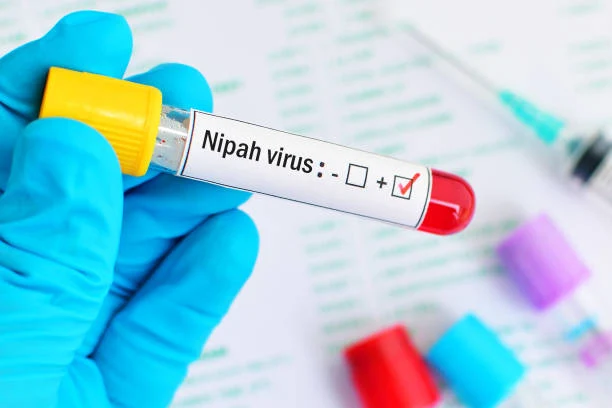 28092023 - BANUATODAY.COM - ILUSTRASI - Virus Nipah - Shutterstock.jpg