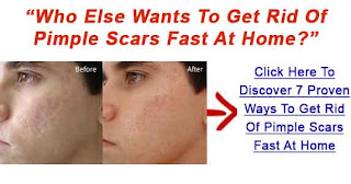 how to reduce acne scars