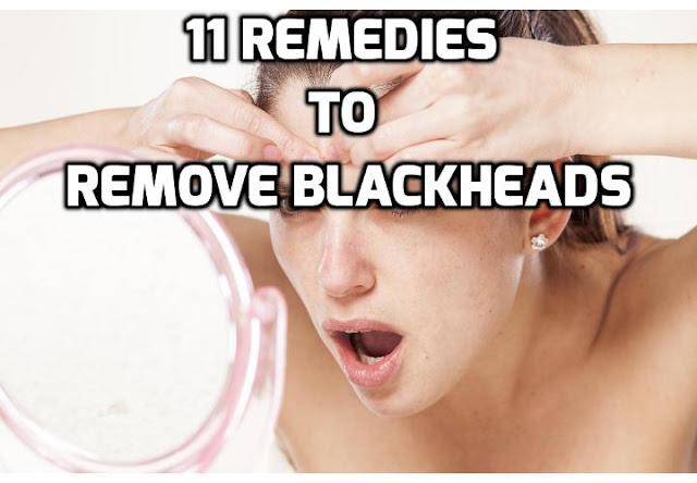 Common and annoying, blackheads occur when your pores become clogged with excess oil and dead skin cells. Read on to find out about the 11 simple remedies to get rid of blackheads naturally. 