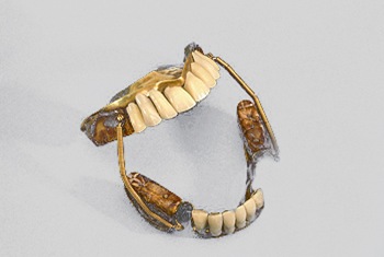 Sheva Apelbaum 19th century dentures