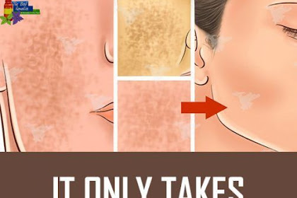 It Only Takes 1 Ingredient To Remove Pores On Your Face At Home