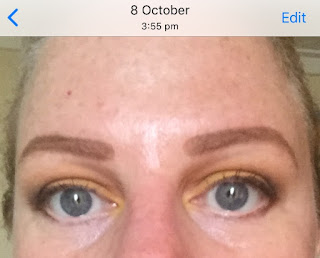 Sept to oct 2018 of using Glyco Skincare 360 Eye Contour Creme
