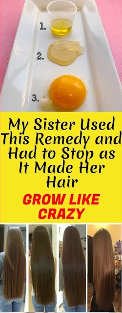 My Sister Used This Remedy And Had To Stop as it Made Her Hair Grow Like Crazy!