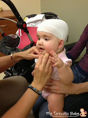 Baby with torticollis has a stockinette cap on her head