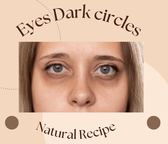 Eyes | Dark circles | Get rid of dark circles naturally