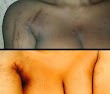 Ladies! Stretchmarks Are Not Sexy ...get rid of them! (SEE PHOTOS)