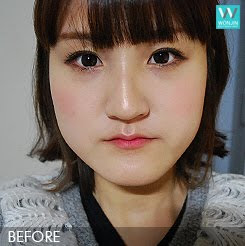 짱이뻐! - Got Chance To Do Korean Face Contour and Two Jaw Surgery 