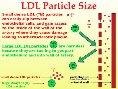 Understanding updated cholesterol testing - NMR particle test