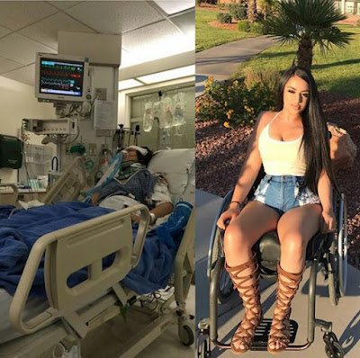  "Though this wheelchair is part of me it will never define me" - Stunning young lady who was left a paraplegic after an accident