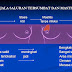 Saluran Susu Tersumbat