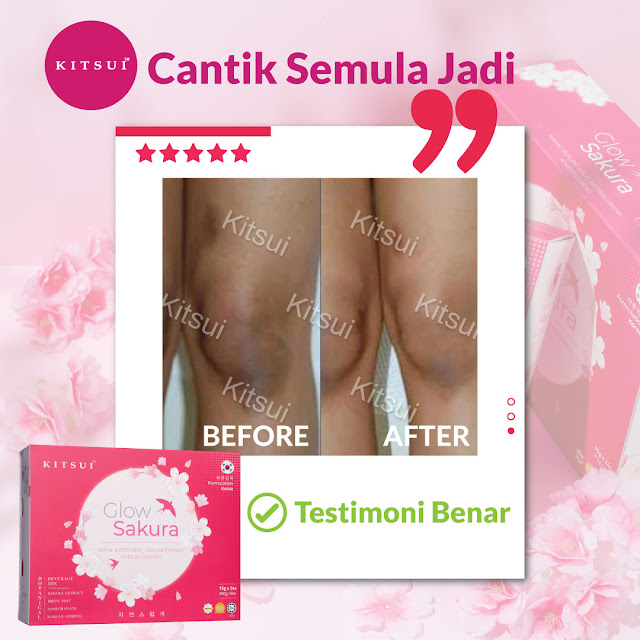 Kitsui Glow Sakura Sarang Burung Walit, Tingkatkan Aura Wajah Secara Semulajadi dengan Formulasi dari Korea, kitsui glow sakura, kitsui glow sakura review, kitsui Malaysia, kejelitaan kulit bermula dari dalaman, kitsui Korean whitie, produk kitsui untuk kurus dan putih, kitsui Korean white side effect, kitsui Korean white review, produk kitsui bahaya, pantang larang kitsui Korean white, kitsui Korean white review Malaysia, kitsui Korean white and tomato review, jdt blogger, kitsui bird nest, kitsui product, kitsui review, kitsui malaysia review, kitsui malaysia testimoni, kitsui watsons Malaysia, kitsui new launch, kitsui glow sakura sarang burung walit, kitsui glow sakura royal bird nest