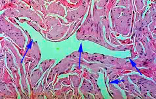 <Img src ="histologia-tejido-eréctil-pene.jpg" width = "475" height "300" border = "0" alt = "Vasos del tejido eréctil del pene tapizados por epitelio.">