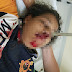 Mulher crava faca no rosto de jovem durante confusão em boca de fumo em Cáceres