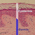 Anatomy and Physiology of the Skin  : Epidermis 