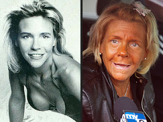 Tan mom before and after tanning beds.