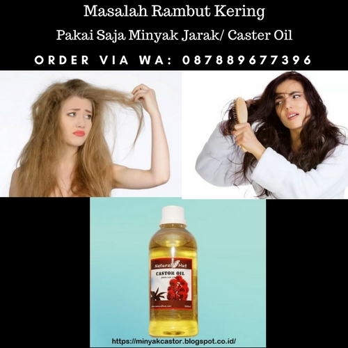 Jual Minyak Jarak Murni, Jual Castor Oil Untuk Rambut, Cara Mengatasi Rambut Rontok