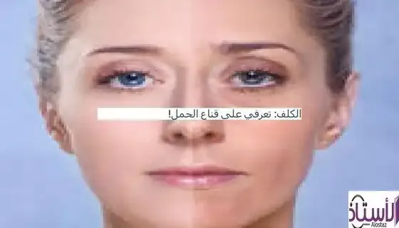Watch-the-video-to-learn-about-the-pregnancy-mask-melasma