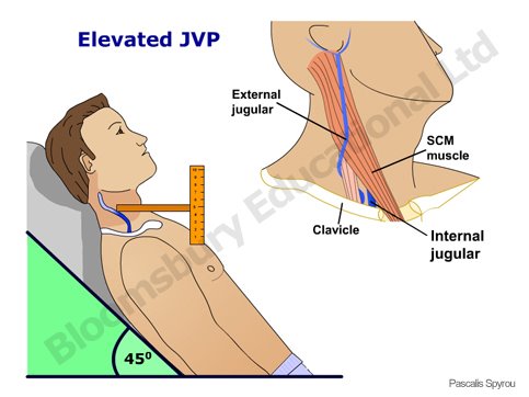 some facts of JVP