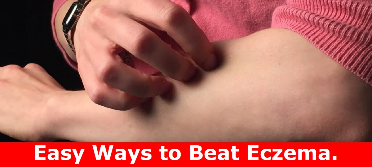 Easy Ways to Beat Eczema.