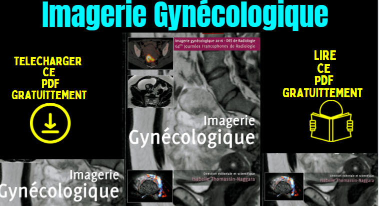 Imagerie Gynécologique pdf Gratuit
