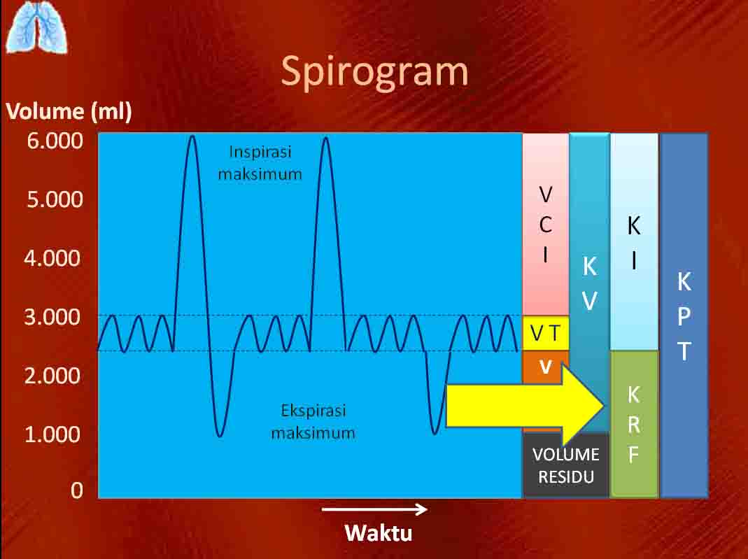 Klik paru ASPEK KLINIK KAPASITAS RESIDU FUNGSIONAL PEEP 