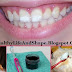 How to Remove White Spots on Teeth Permanently