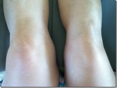 knee 2