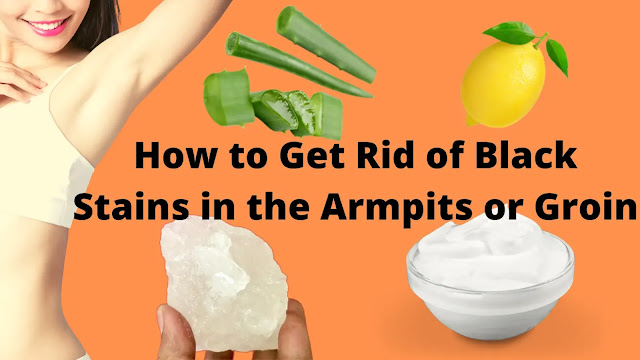 How to Get Rid of Black Stains in the Armpits or Groin