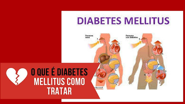 O que e diabete mellitus