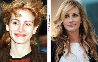 Julia Roberts Before and After